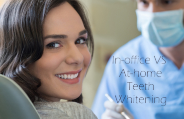In-Office vs At-Home Teeth Whitening