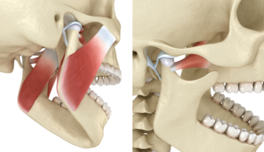 How TMJ Injections Can Help You Get Rid of Jaw Pain