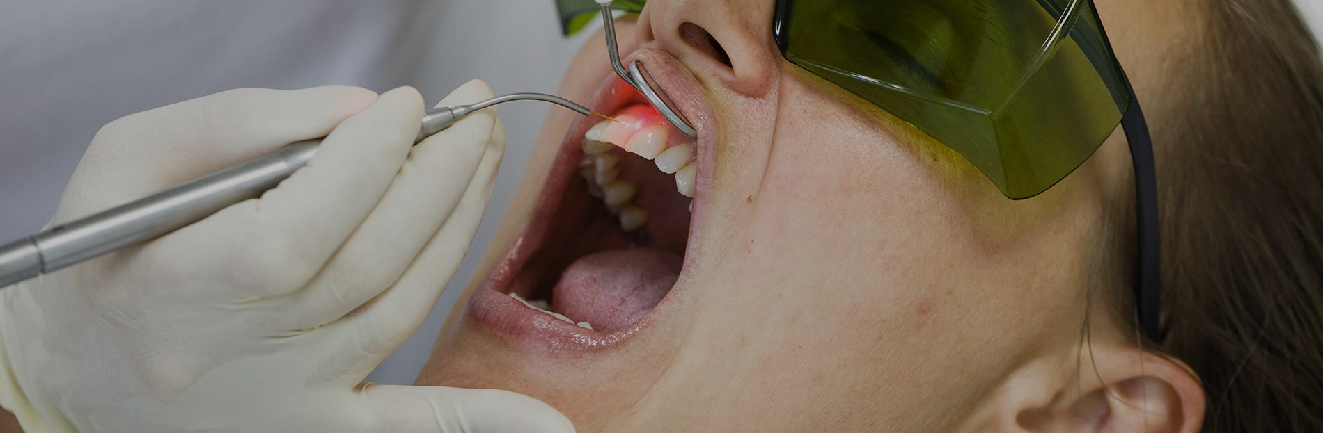 Laser Dentistry Minimally Invasive Procedures