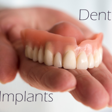 Dentures vs Dental Implants