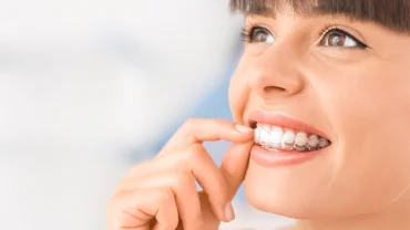 Smile After Orthodontic Treatment in Summerlin