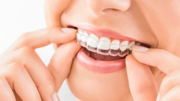 Functional Aesthetic Dentistry