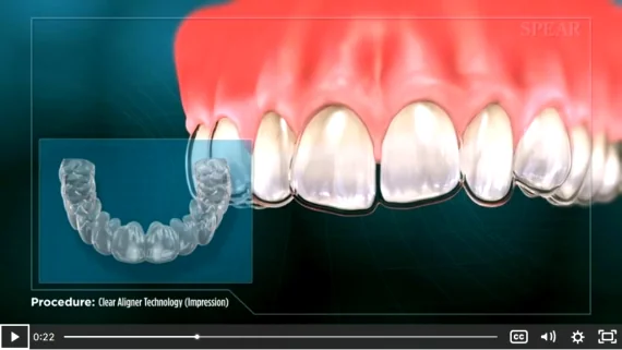 Orthodontics procedure educational video