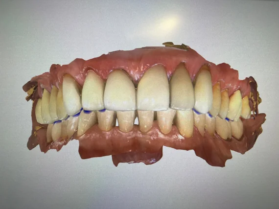 Digital Image for Same Day Dentistry
