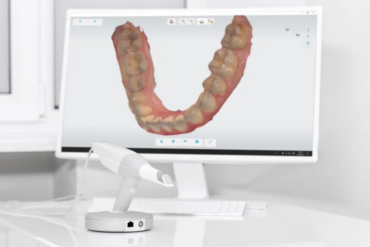 Dental Digital Impressions, Revolutionizing the Dental Experience