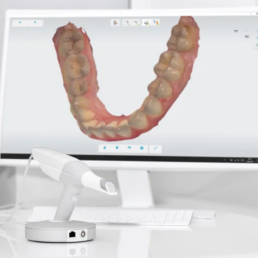 Dental Digital Impressions, Revolutionizing the Dental Experience