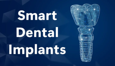 Advancements in Smart Dental Implants