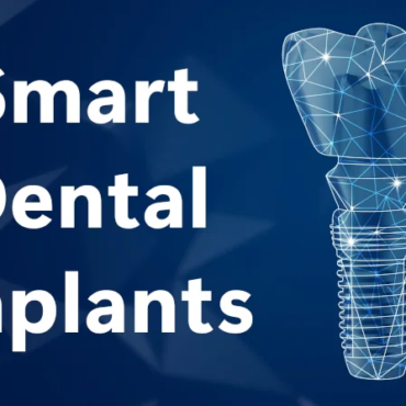 Advancements in Smart Dental Implants