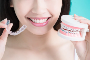 Orthodontic Revolution: Shaping the Future of Smile Enhancement