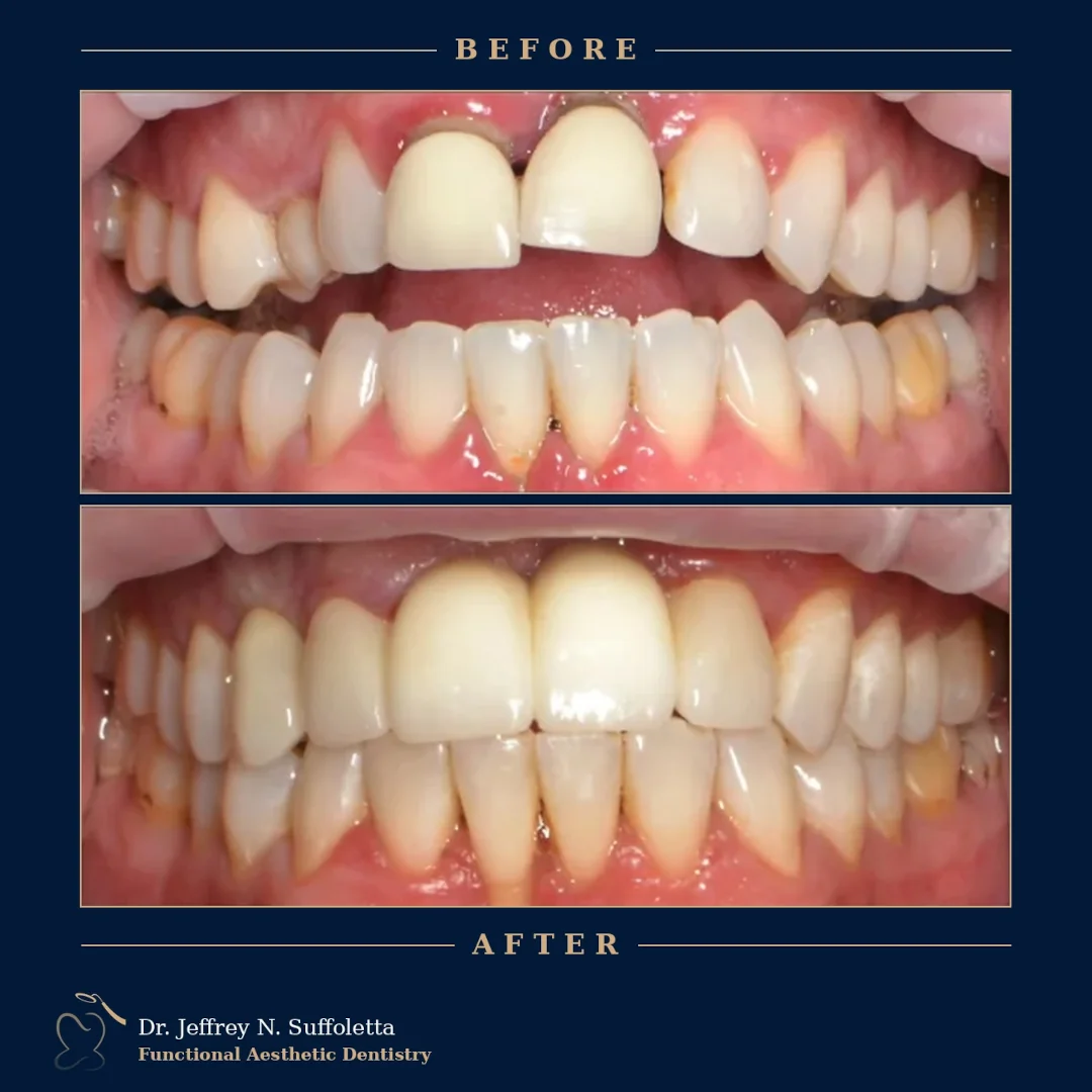 Aesthetic Dentistry in Summerlin Aesthetic Dentistry in Summerlin