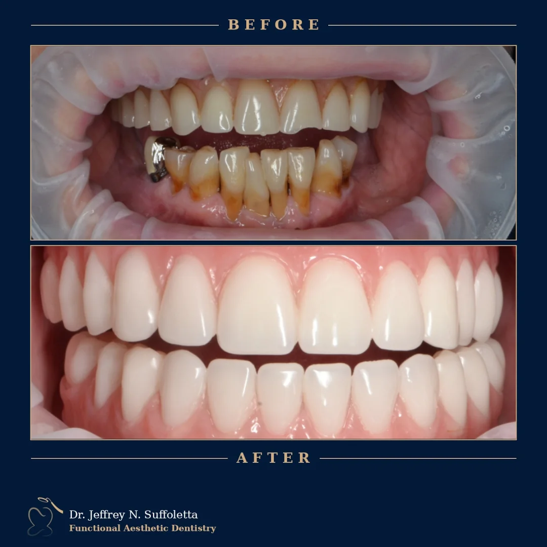 Before and After Cosmetic Dentistry Las Vegas Before and After Cosmetic Dentistry Las Vegas