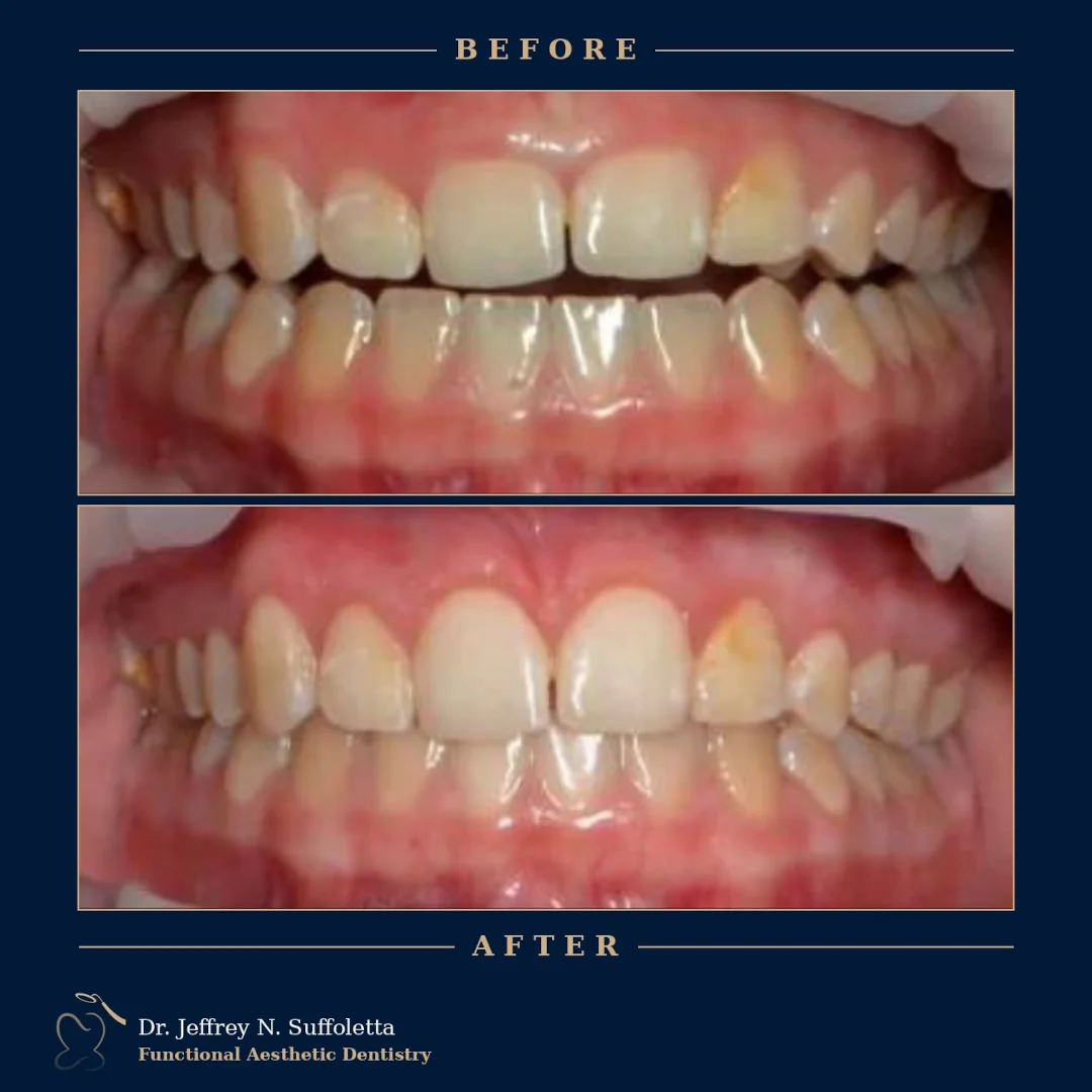 Cosmetic Dental Treatment Las Vegas Cosmetic Dental Treatment Las Vegas